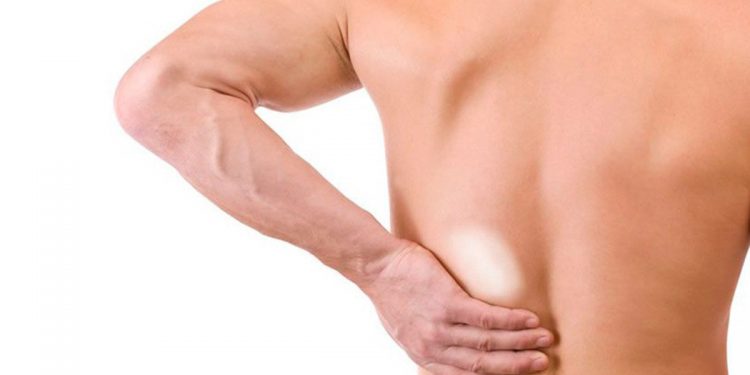 Casos de hanseníase no Espirito Santo não chegam à metade dos de outros Estados