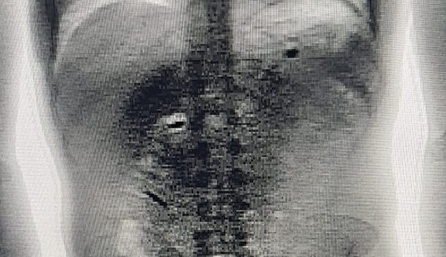 Presidiário com saída temporária é preso após defecar 500 gr de fumo que iria levar para o presídio