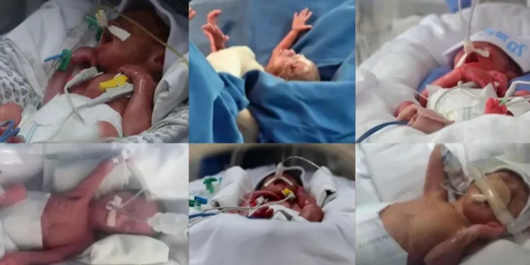 Morre Theo, um dos sêxtuplos nascidos em Colatina