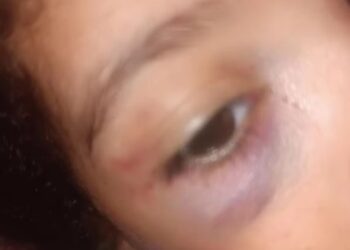 “Que a justiça seja feita. Todas elas”, pede mãe que teve filho agredido por padrasto em Mantena
