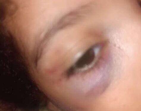 “Que a justiça seja feita. Todas elas”, pede mãe que teve filho agredido por padrasto em Mantena