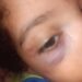 “Que a justiça seja feita. Todas elas”, pede mãe que teve filho agredido por padrasto em Mantena “Que a justiça seja feita. Todas elas”, pede mãe que teve filho agredido por padrasto em Mantena