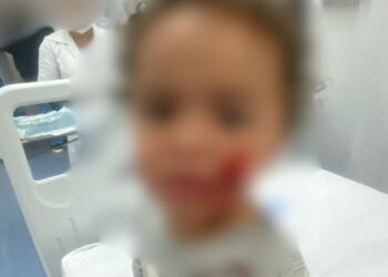 Bebê de 1 ano e 7 meses é atacado por pitbull em Marataízes, no Espírito Santo