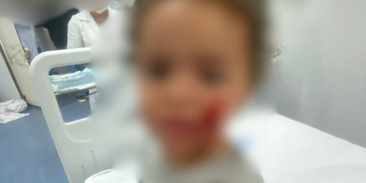 Bebê de 1 ano e 7 meses é atacado por pitbull em Marataízes, no Espírito Santo Bebê de 1 ano e 7 meses é atacado por pitbull em Marataízes, no Espírito Santo