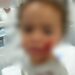 Bebê de 1 ano e 7 meses é atacado por pitbull em Marataízes, no Espírito Santo Bebê de 1 ano e 7 meses é atacado por pitbull em Marataízes, no Espírito Santo
