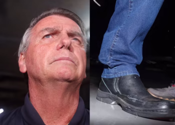 Bolsonaro chama medidas do STF de “suprema humilhação” após primeira entrevista com tornozeleira eletrônica