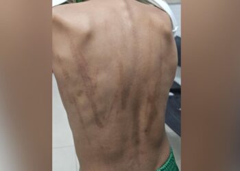 Criança é levada para abrigo após apanhar do pai com vara de goiabeira no ES