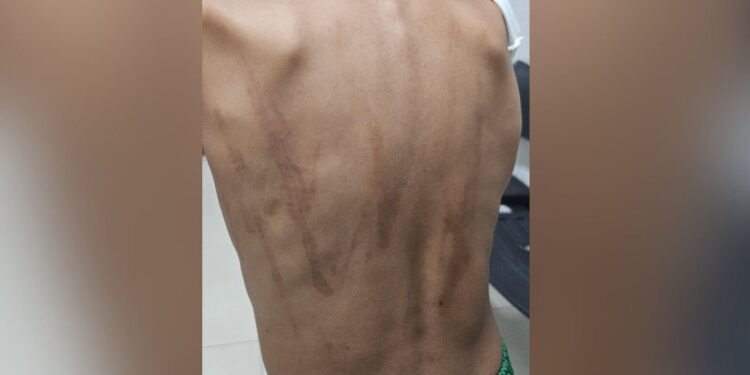 Criança é levada para abrigo após apanhar do pai com vara de goiabeira no ES Criança é levada para abrigo após apanhar do pai com vara de goiabeira no ES