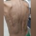 Criança é levada para abrigo após apanhar do pai com vara de goiabeira no ES