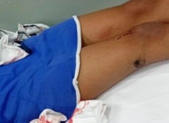 Menina de 10 anos é atropelada por moto a caminho da escola em Colatina