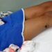 Menina de 10 anos é atropelada por moto a caminho da escola em Colatina Menina de 10 anos é atropelada por moto a caminho da escola em Colatina